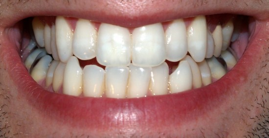 Teeth by David Shankbone